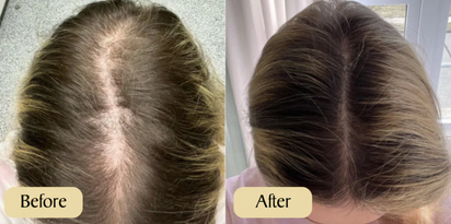 Aceite de Batana y Romero Beldo