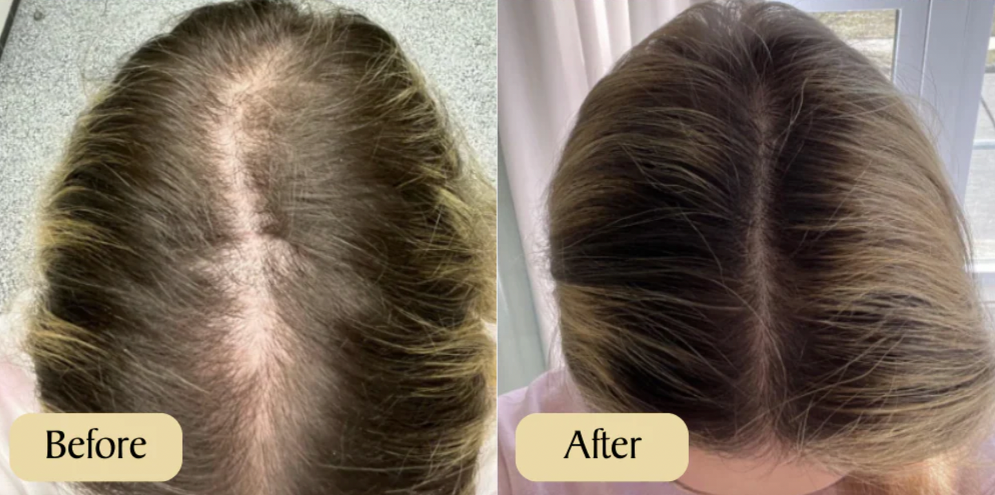 Aceite de Batana y Romero Beldo